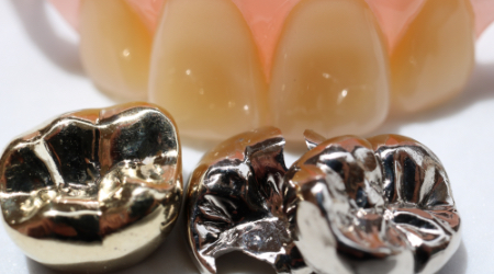 義歯（入れ歯）、被せ物・詰め物等の治療について